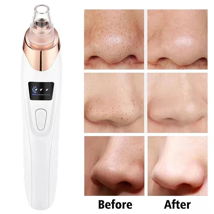 Electric Facial Skin Care Pore Removal Cleanser
